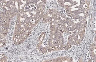 Lass2 Antibody Hl1717 Ab308189  Immunohistochemistry Paraffin Embedded Sections Img407277