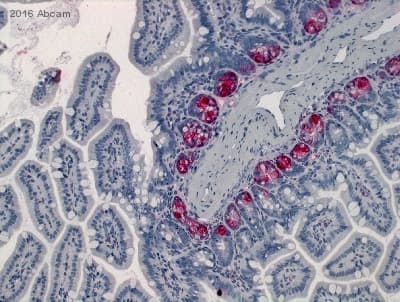 Anti-Lysozyme antibody [EPR2994(2)](AB108508)