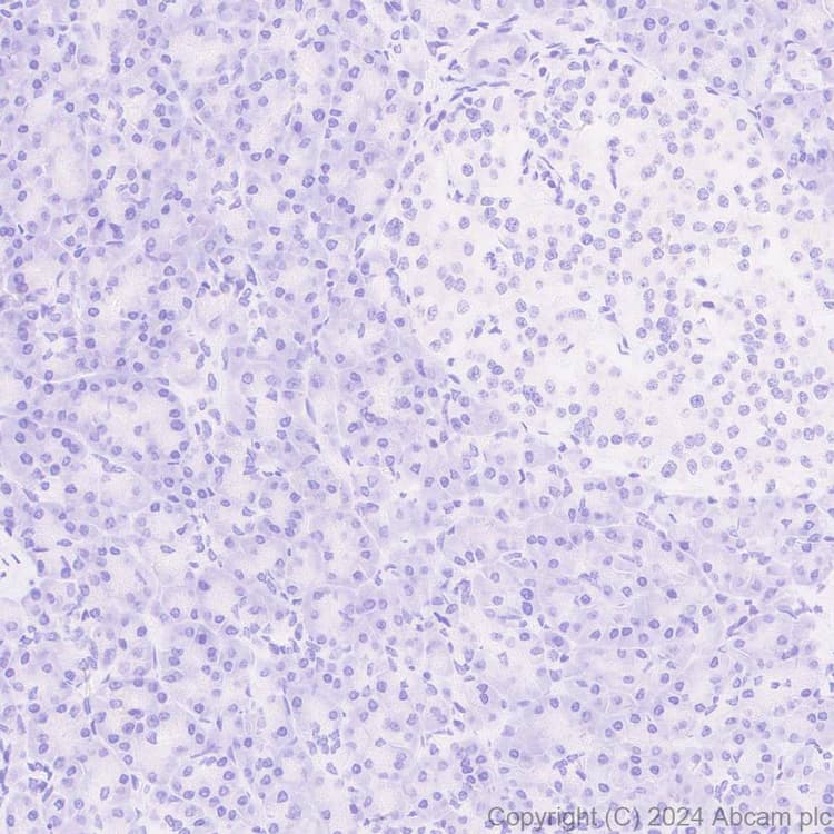 Anti-Adenovirus Type 5 Hexon antibody [EPR28237-57](AB316852)