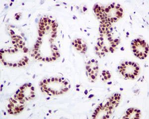 Hmgb2 Antibody Epr6301 Ab124670  Immunohistochemistry Formalin Pfa Fixed Paraffin Embedded Sections Img122514