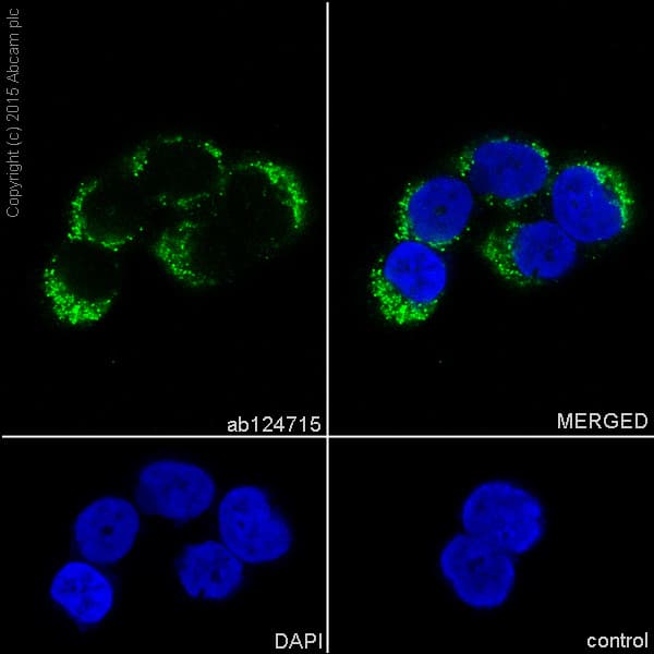 Anti-BMP4 antibody [EPR6211](AB124715)