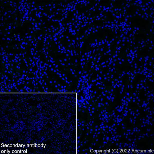 Anti-Aquaporin 5 antibody [EPR27474-70] - BSA and Azide free(AB305304)