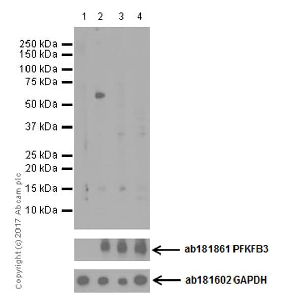 Anti-PFKFB3 (phospho S461) antibody [EPR19735](AB202291)