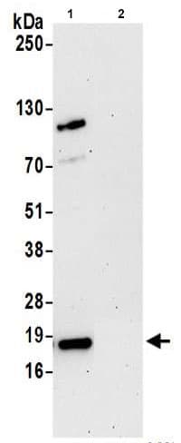 Arpc4 Antibody Ab217065  Immunoprecipitation Img94267