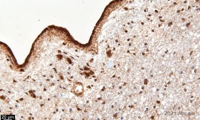 Anti-COX IV antibody - Mitochondrial Loading Control(AB16056)