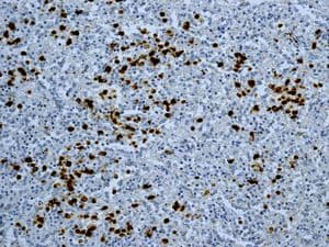 Anti-S100P antibody [EPR6142](AB124743)