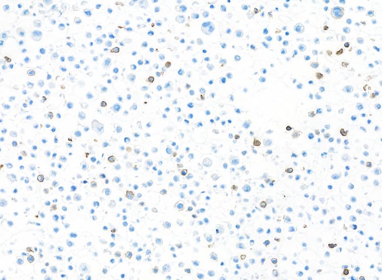 Anti-CD103/ITGAE antibody [BLR171J] - BSA free(AB314101)