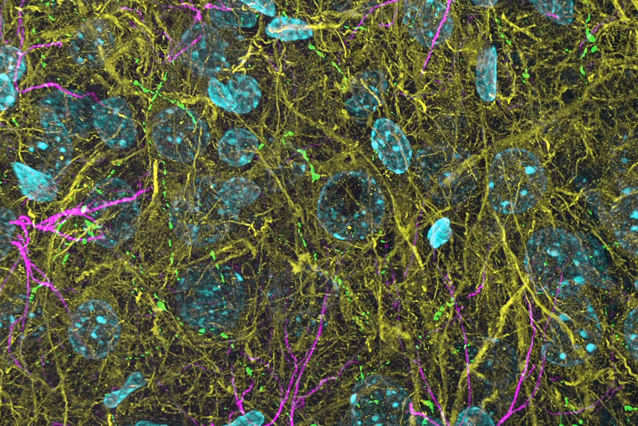 3D THUNDERed Spinning Disk Image Of Mouse Brain Kid21754304