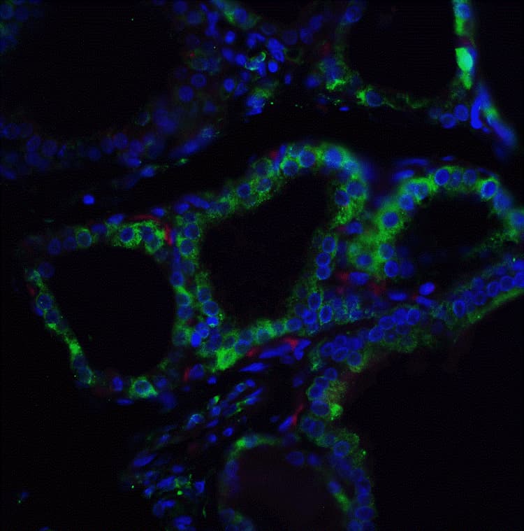 Anti-RSPO1 antibody(AB106556)