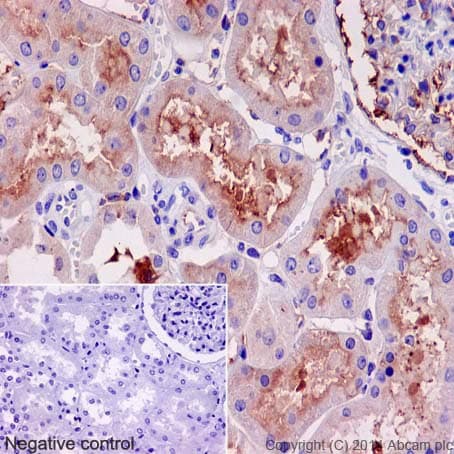 Anti-Klotho antibody [EPR6856](AB181373)