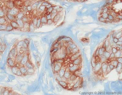 Anti-EpCAM antibody(AB71916)