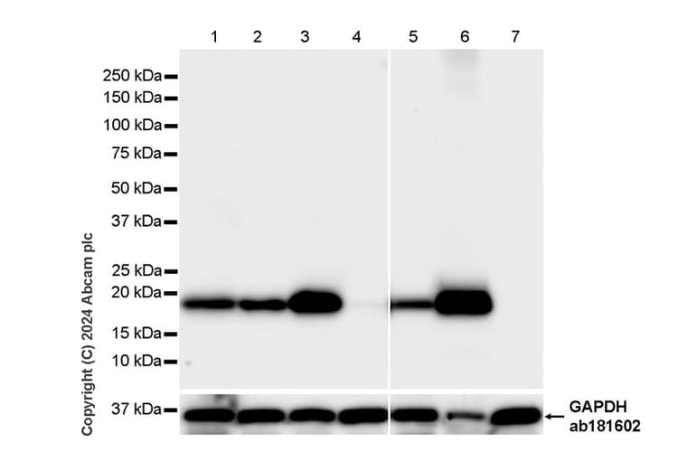 Anti-Claudin 1 antibody [RM1186](AB317709)