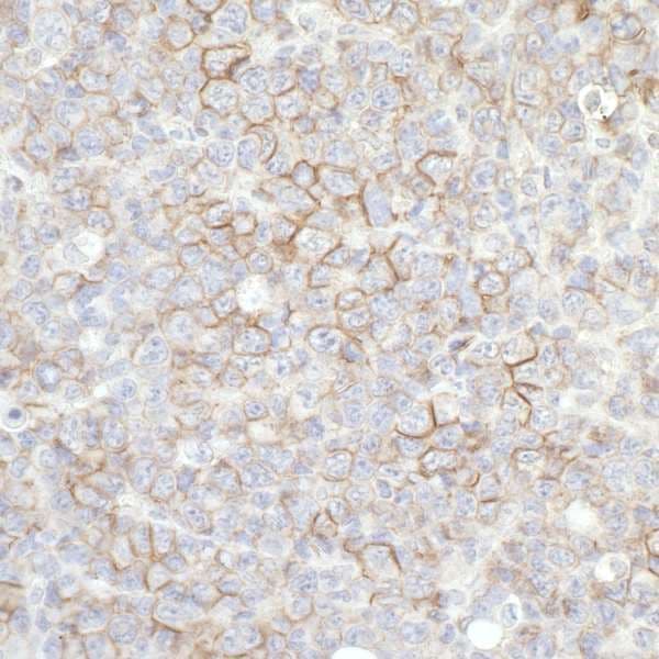 Anti-CD44 antibody(AB157107)