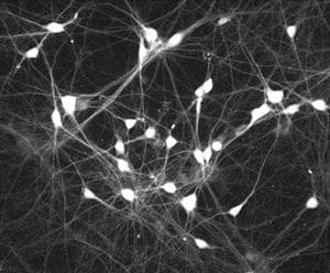 Anti-PGP9.5 antibody [13C4 / I3C4](AB8189)