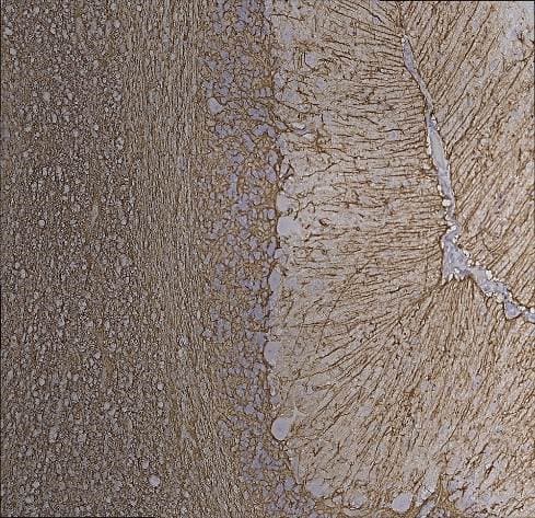 Anti-GFAP antibody [2A5](AB4648)