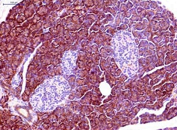 Anti-Aquaporin 1 antibody [1/22](ab9566)