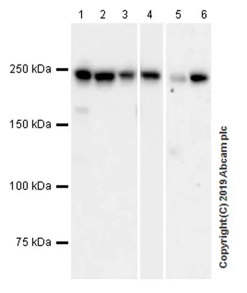 Anti-non-muscle Myosin IIB/MYH10 antibody [EPR22564-23](AB230823)