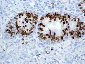 Anti-Ki67 antibody [EPR3610](AB92742)