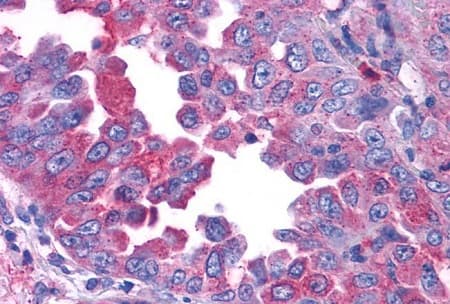 Anti-CRF1/CRHR1 antibody - N-terminal(AB230803)