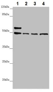 Anti-AP1M1 antibody(AB230273)