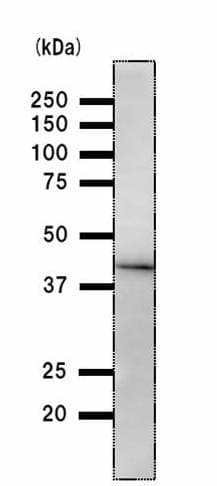 Anti-DDB2 antibody [2246C4a](AB51017)