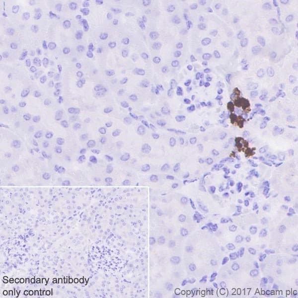 Anti-Renin antibody [EPR20693](AB212197)