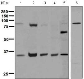 Anti-Syndecan-1 antibody [EPR6454](AB128936)