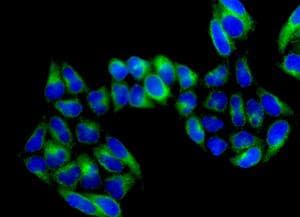 Anti-ATP6V1D antibody [EPR11326(B)](AB157458)