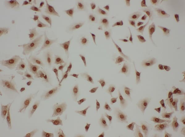 Anti-LASP1 antibody - N-terminal(AB191022)