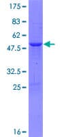 Recombinant Human TP73-AS1 protein(AB163525)