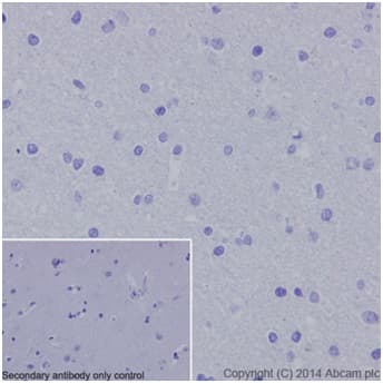 Anti-PRDM1/Blimp1 antibody [EPR16655] - BSA and Azide free(AB240344)