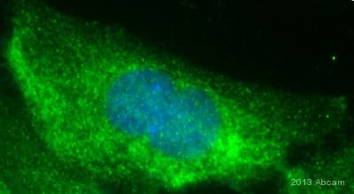 Anti-RAB7 antibody [EPR7589](AB137029)