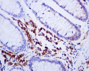 Anti-Syndecan-1 antibody [EPR6454](AB128936)