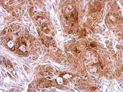 Anti-Osteoprotegerin antibody(AB183910)