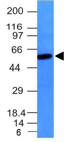 Vimentin Antibody Vm452 Bsa And Azide Free Ab212942  Western Blot Img43317