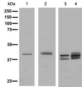 Ttf1 Nkx2 1 Antibody Epr8190 138 Ab137061  Western Blot Img81544