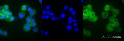 Anti-beta Catenin antibody(AB6302)