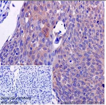 Anti-ATP6V0D1/P39 antibody [EPR18320-38](AB202899)