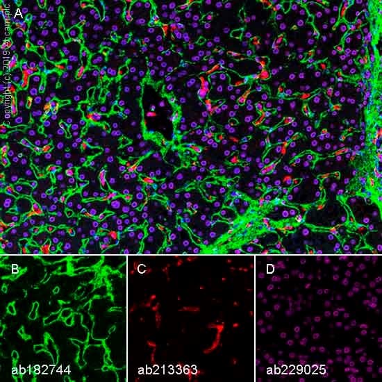 Anti-Collagen VI antibody [EPR17072](AB182744)