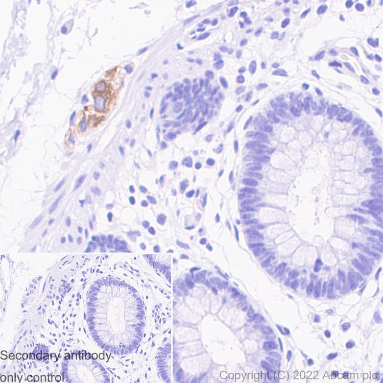 Anti-MAP2 antibody [EPR19691] - Goat IgG (Chimeric)(AB302487)