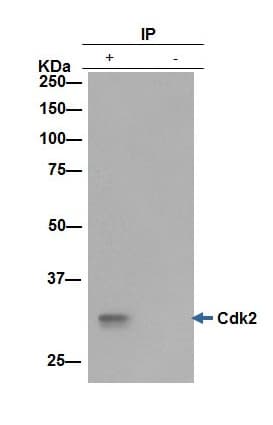 Anti-Cdk2 antibody [E304](AB32147)