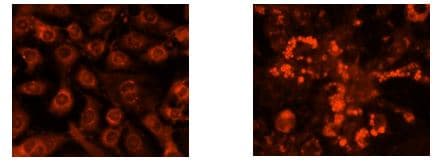 Nile Red Staining Kit(AB228553)