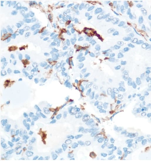 Cd16 Antibody Sp175 Ab183354  Immunohistochemistry Formalin Pfa Fixed Paraffin Embedded Sections Img73015