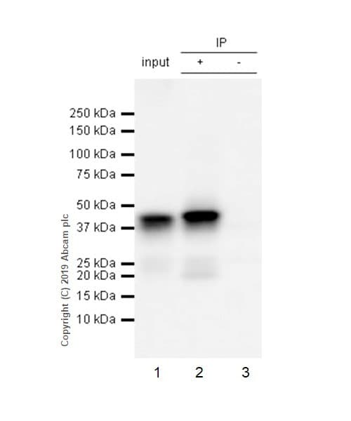 Anti-Islet 1 antibody [EPR10362](AB178400)