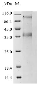 Ab289751  Sds Page Img185586
