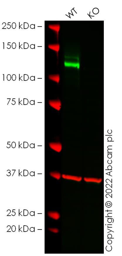 Anti-N Cadherin antibody [EPR1791-4](AB76011)
