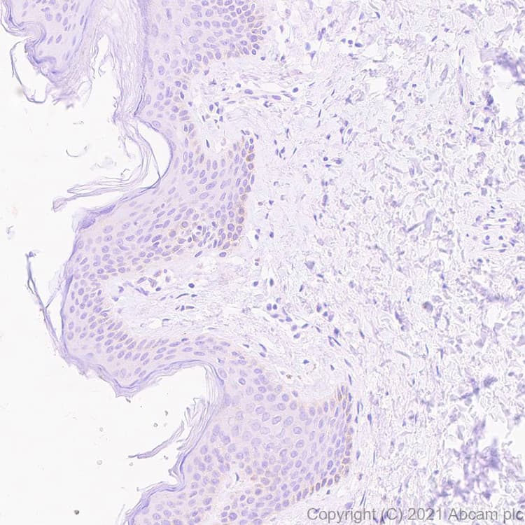 Socs3 Antibody Epr24090 74 Ab280884  Immunohistochemistry Formalin Pfa Fixed Paraffin Embedded Sections Img129240