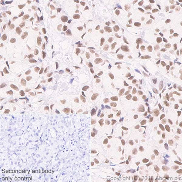 Rad50 Antibody Epr20968 Bsa And Azide Free Ab236460  Immunohistochemistry Formalin Pfa Fixed Paraffin Embedded Sections Img128418