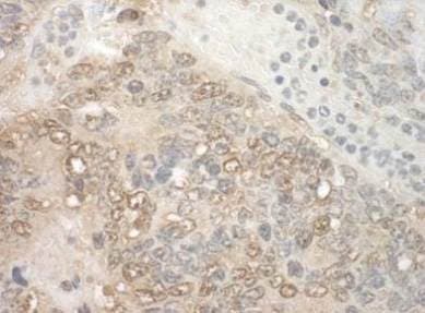 Zch11 Antibody Ab128180  Immunohistochemistry Formalin Pfa Fixed Paraffin Embedded Sections Img114523