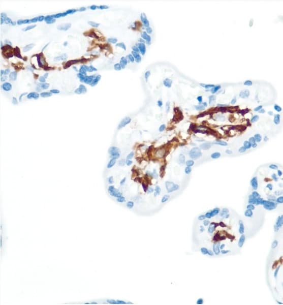 Cd16 Antibody Sp175 Ab183354  Immunohistochemistry Formalin Pfa Fixed Paraffin Embedded Sections Img111302